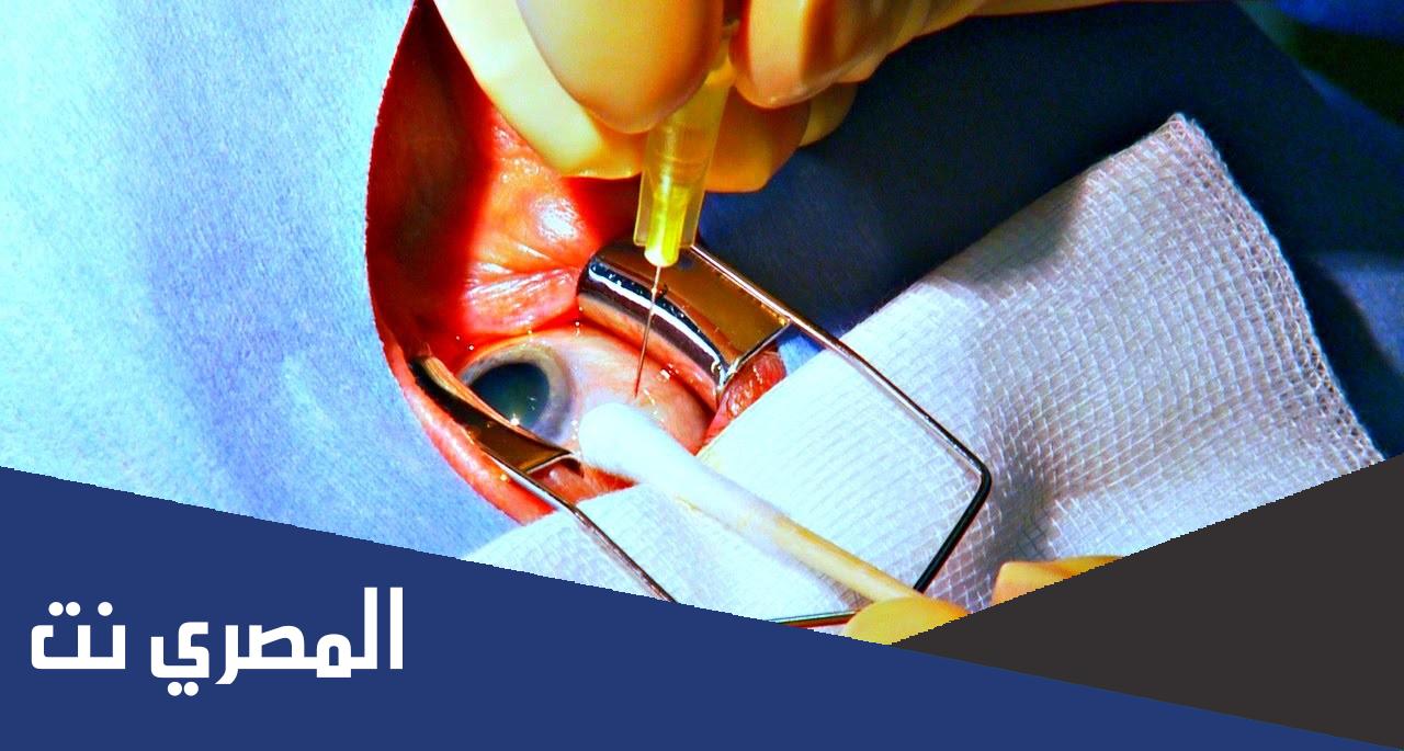 ارتشاح العين بعد عملية المياه البيضاء