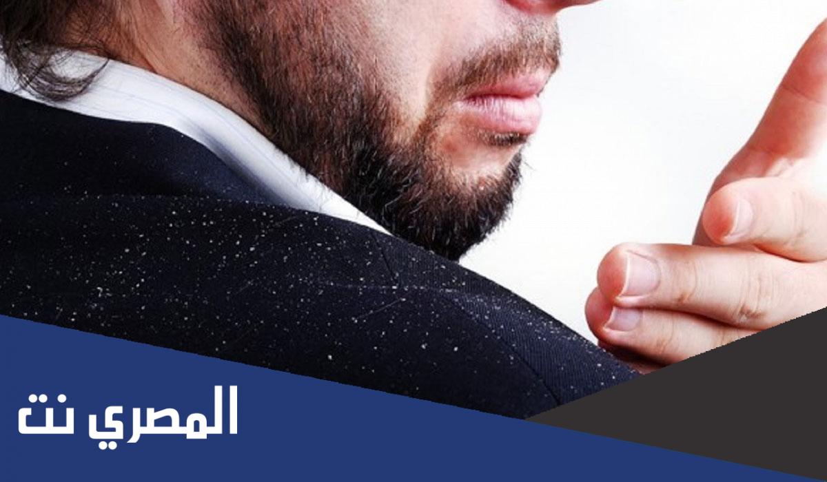 اضرار قشرة الشعر وعلاجها
