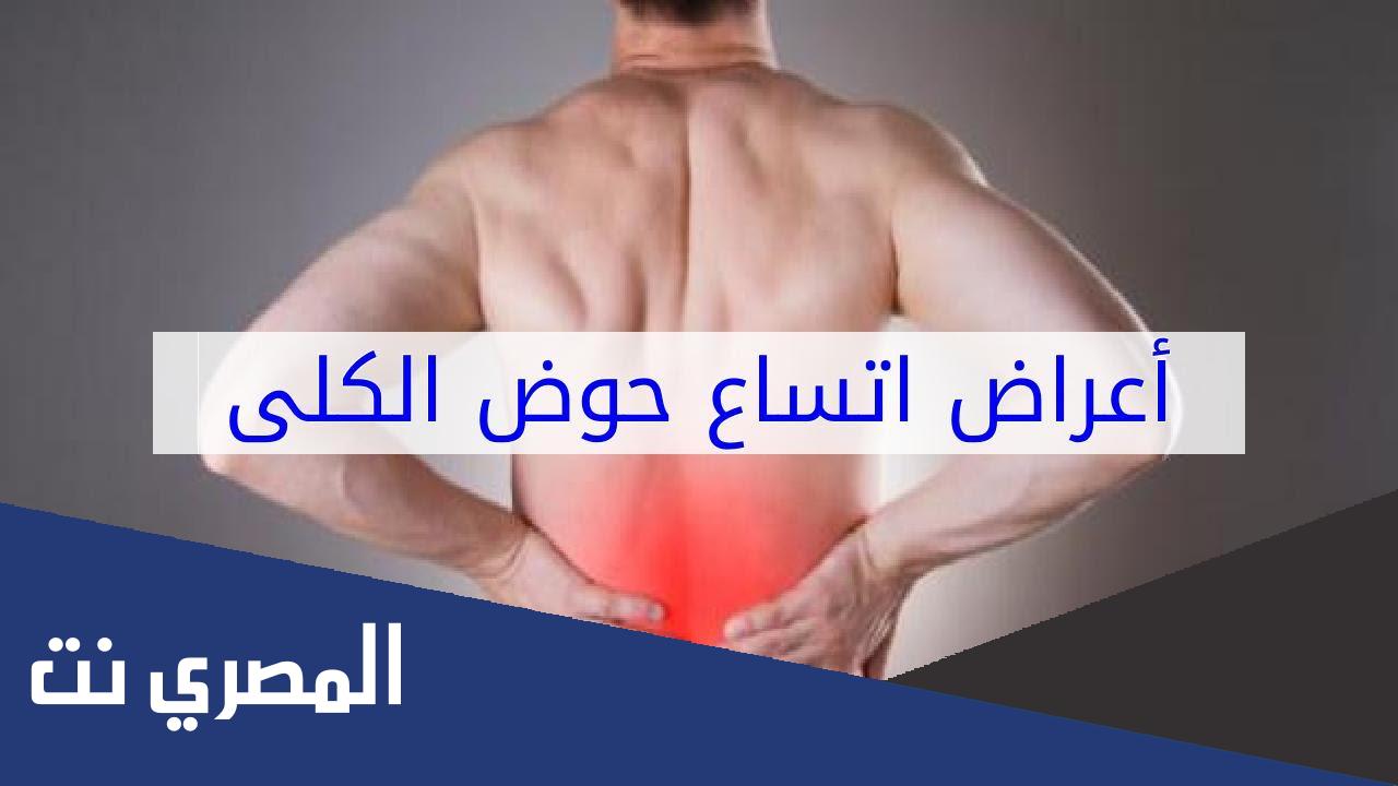 اعراض توسع حوض الكلى