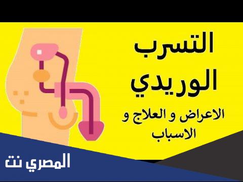 التسرب الوريدى أسبابه وطرق علاجه