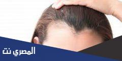علاج تساقط الشعر وتكثيفه
