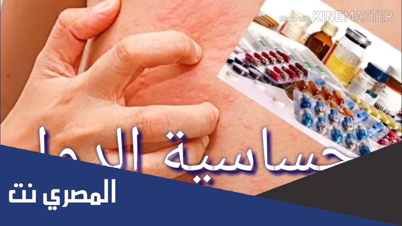 علاج حساسية الدواء