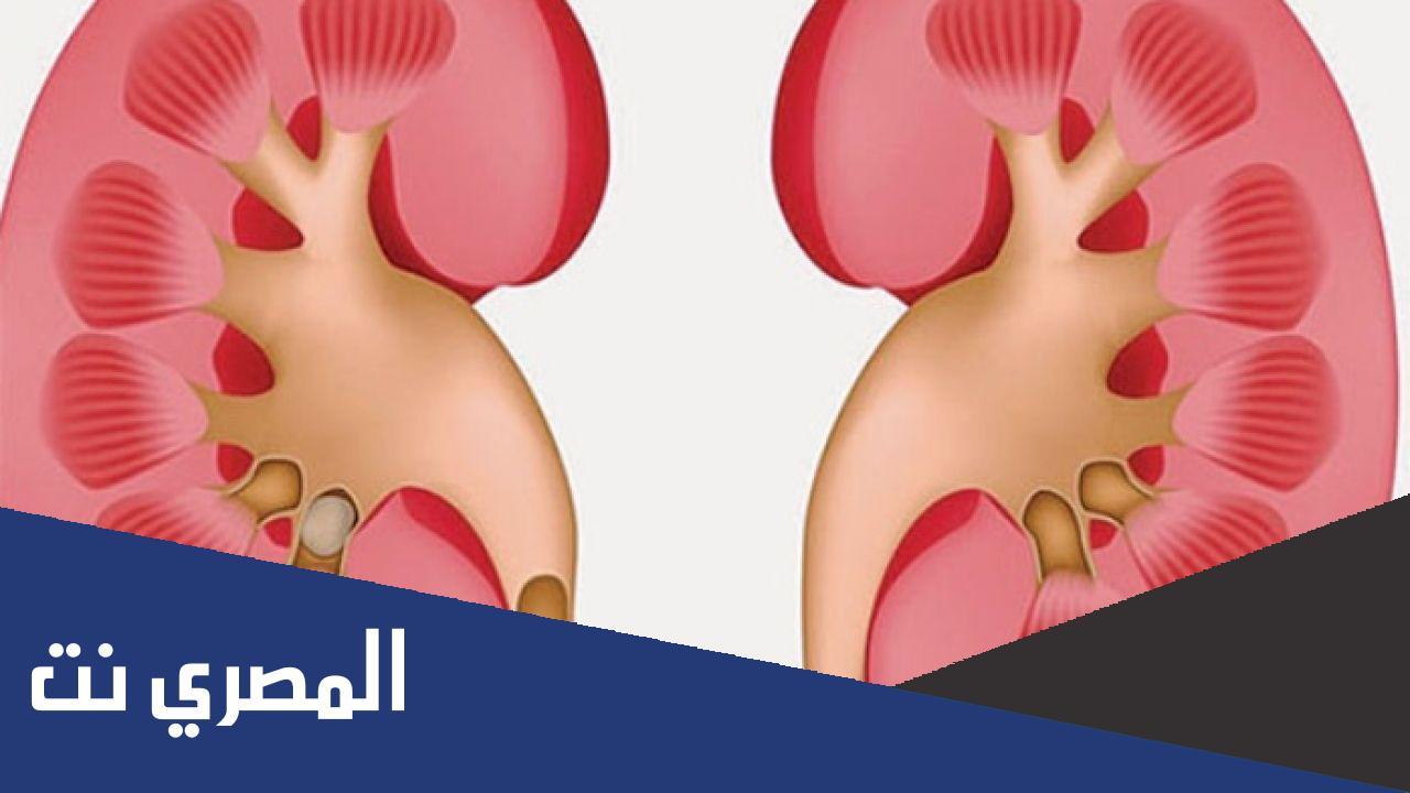 كيفية الوقاية من مرض الفشل الكلوي