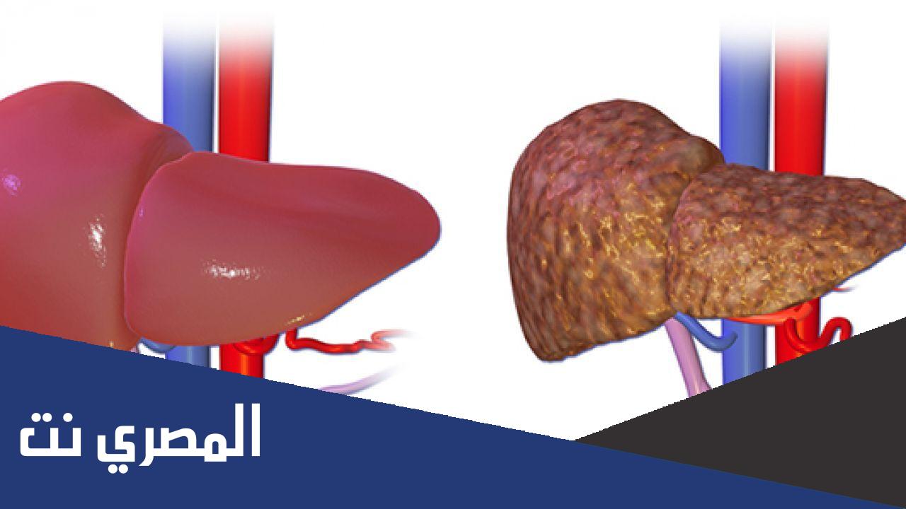 ما الفرق بين تشمع الكبد وتليف الكبد