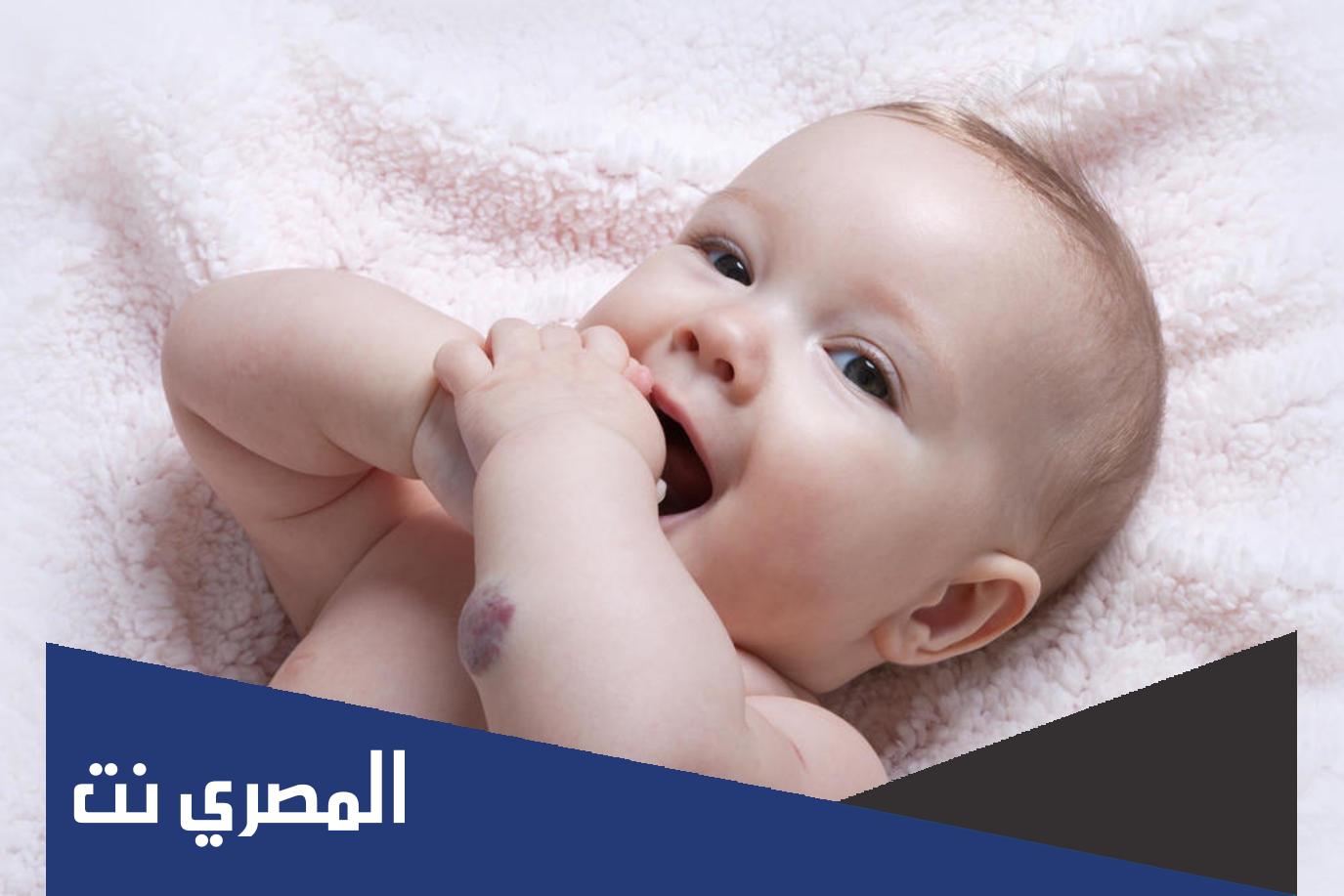 ما معنى وحمة على الكبد
