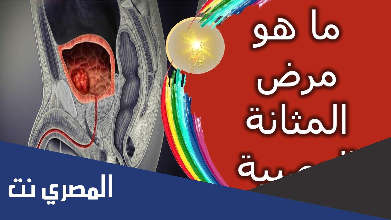 ما هو تعريف مرض المثانة العصبية ؟