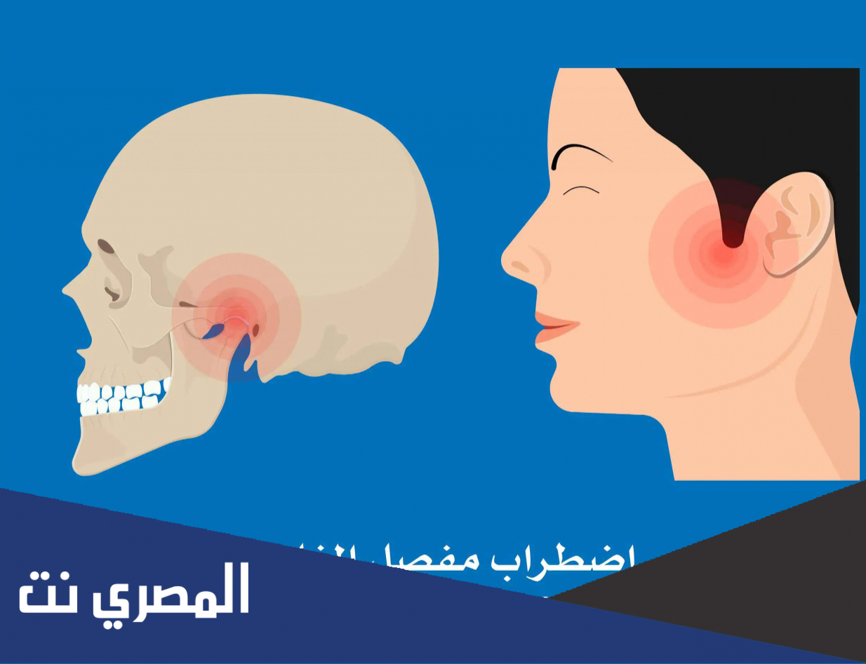 ما هو صداع tmj ?