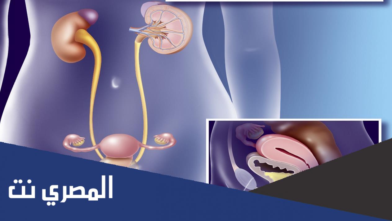 ما هو مرض سلس البول عند النساء ؟