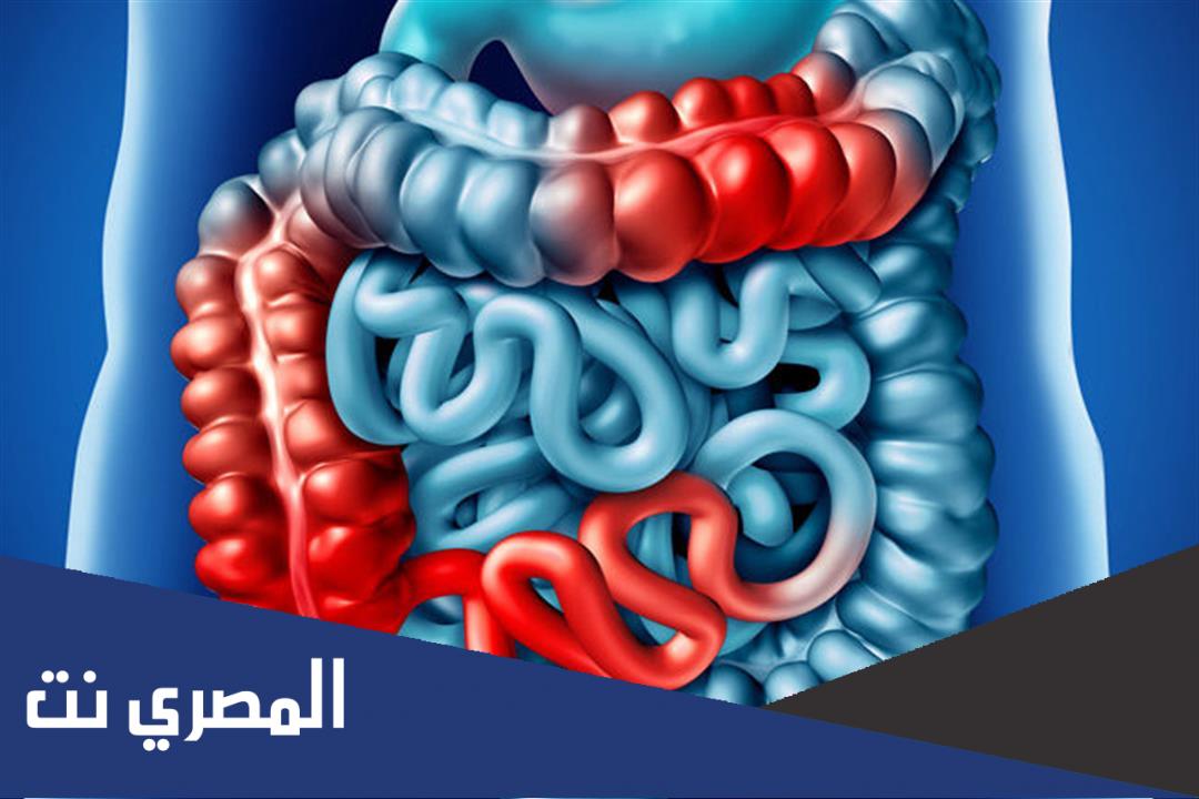 ما هو مرض كرونز المناعي