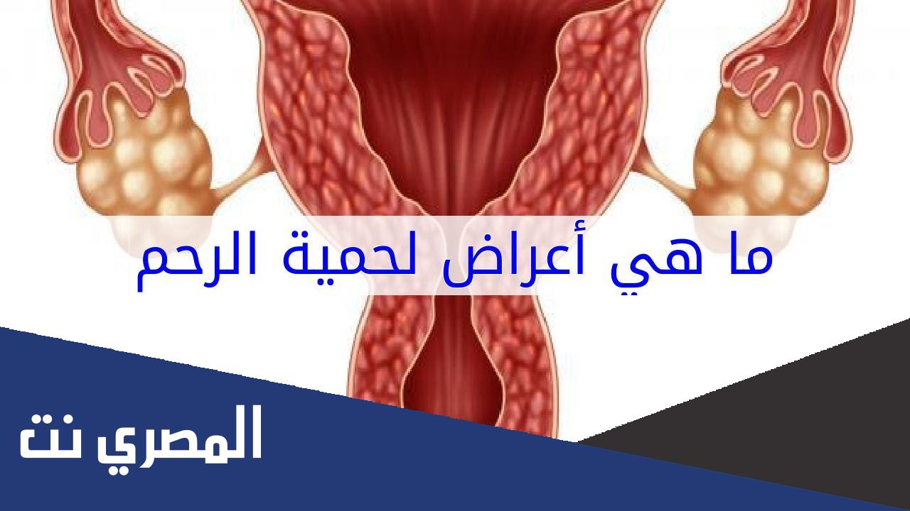 ما هي اعراض اللحمية في الرحم