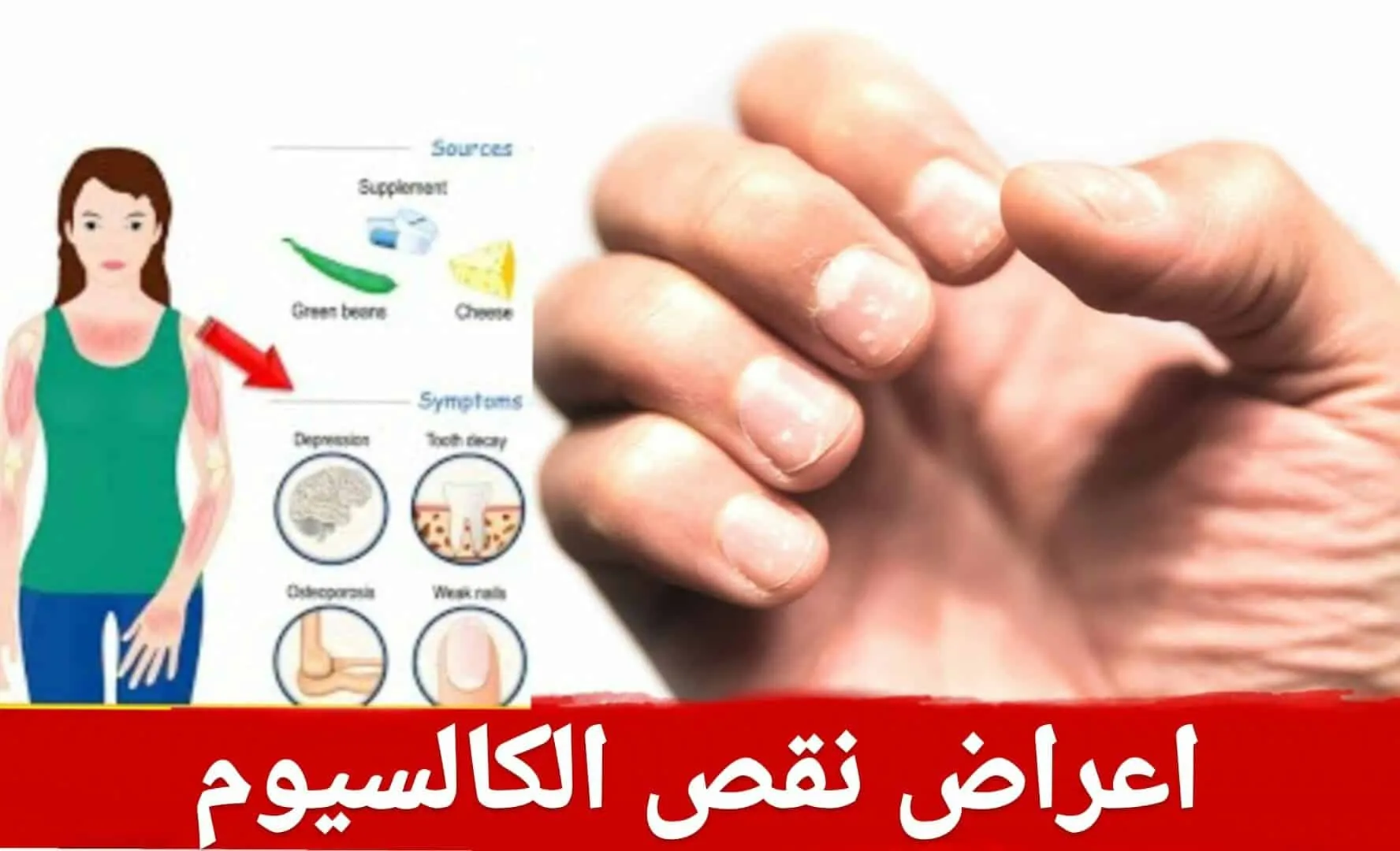 ما هي طرق علاج نقص الكالسيوم
