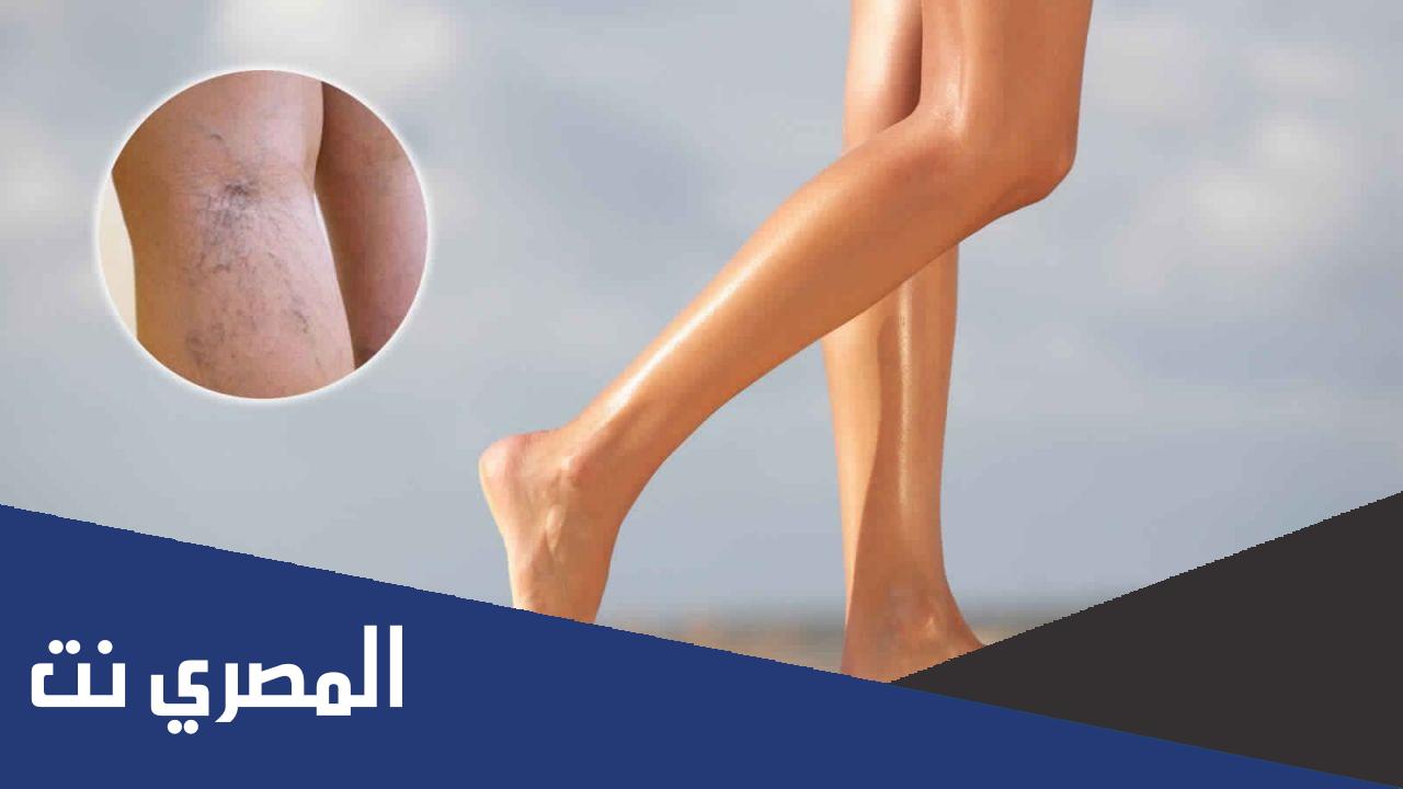 ما هي ظاهرة الرينود