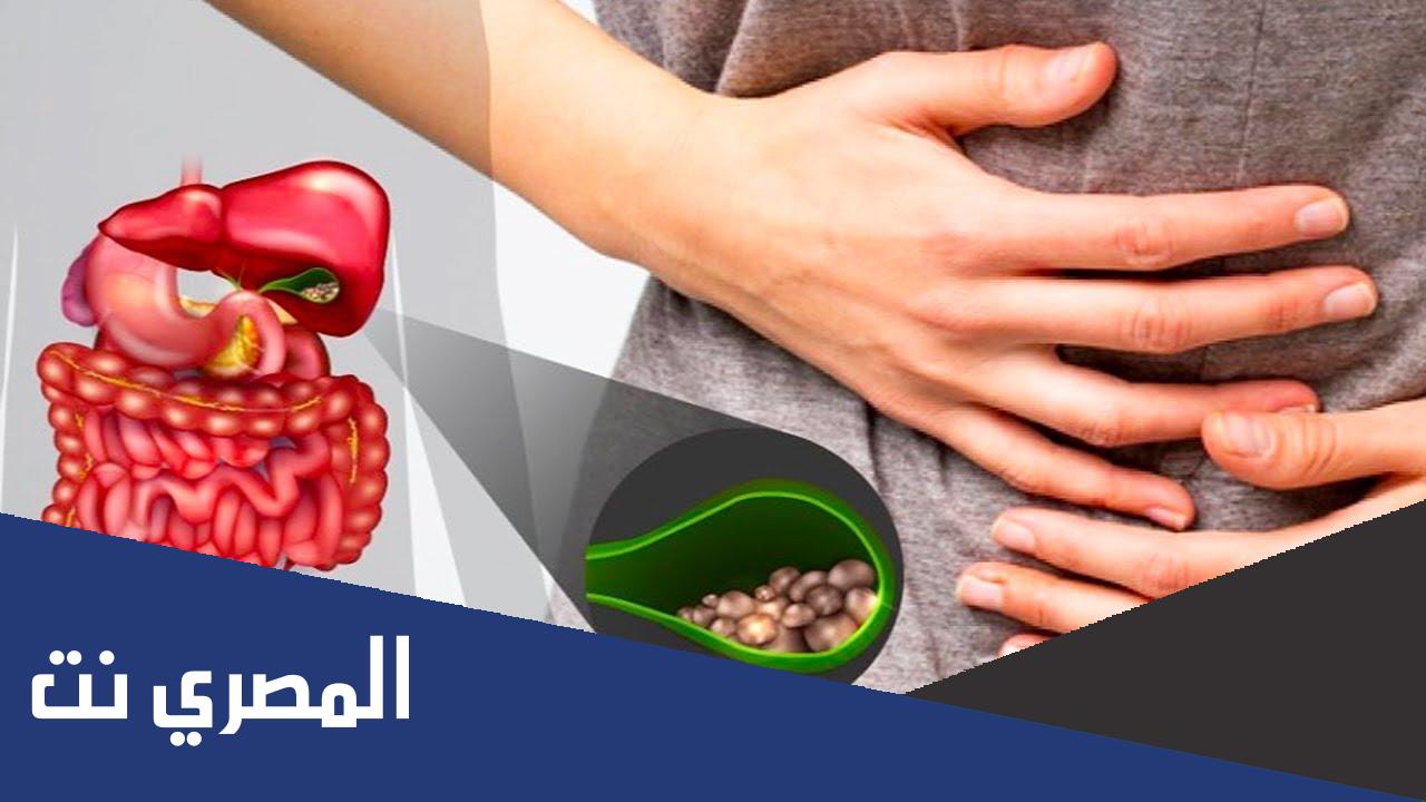 ماذا ياكل مريض التهاب المرارة