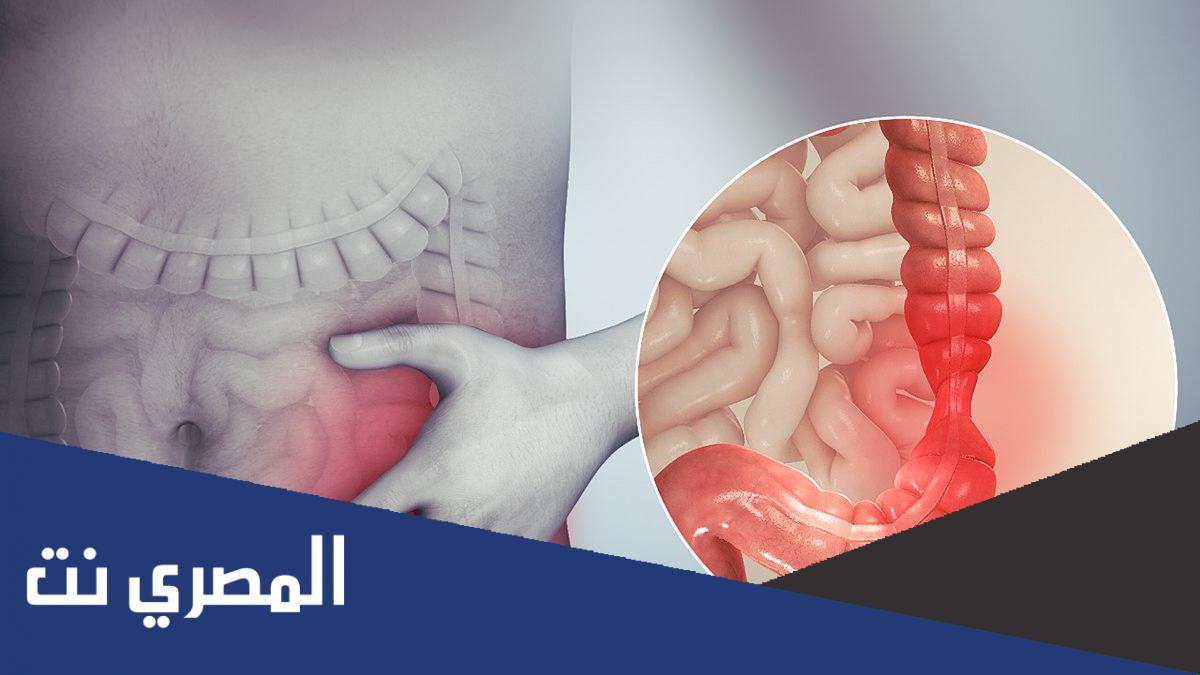 معلومات عامة عن القولون