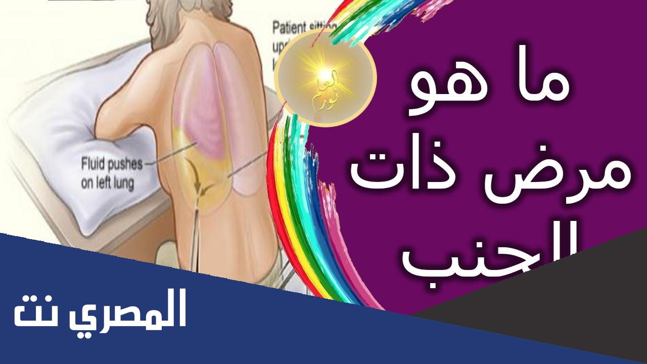 ما معنى صاحب ذات الجنب شهيد