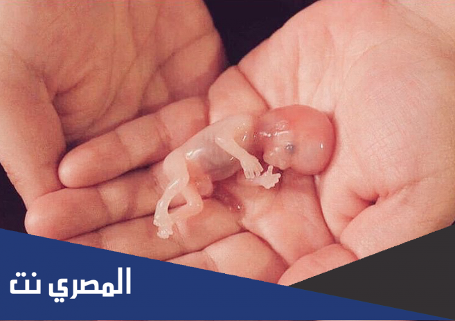 تفسير حلم الاجهاض للحامل