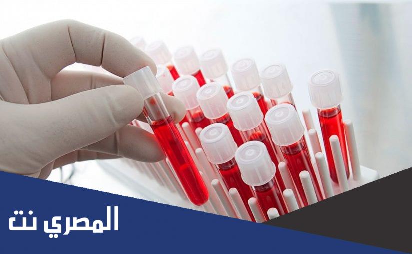 تعرف ما هو تحليل RDW