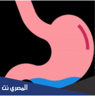 تكميم المعدة