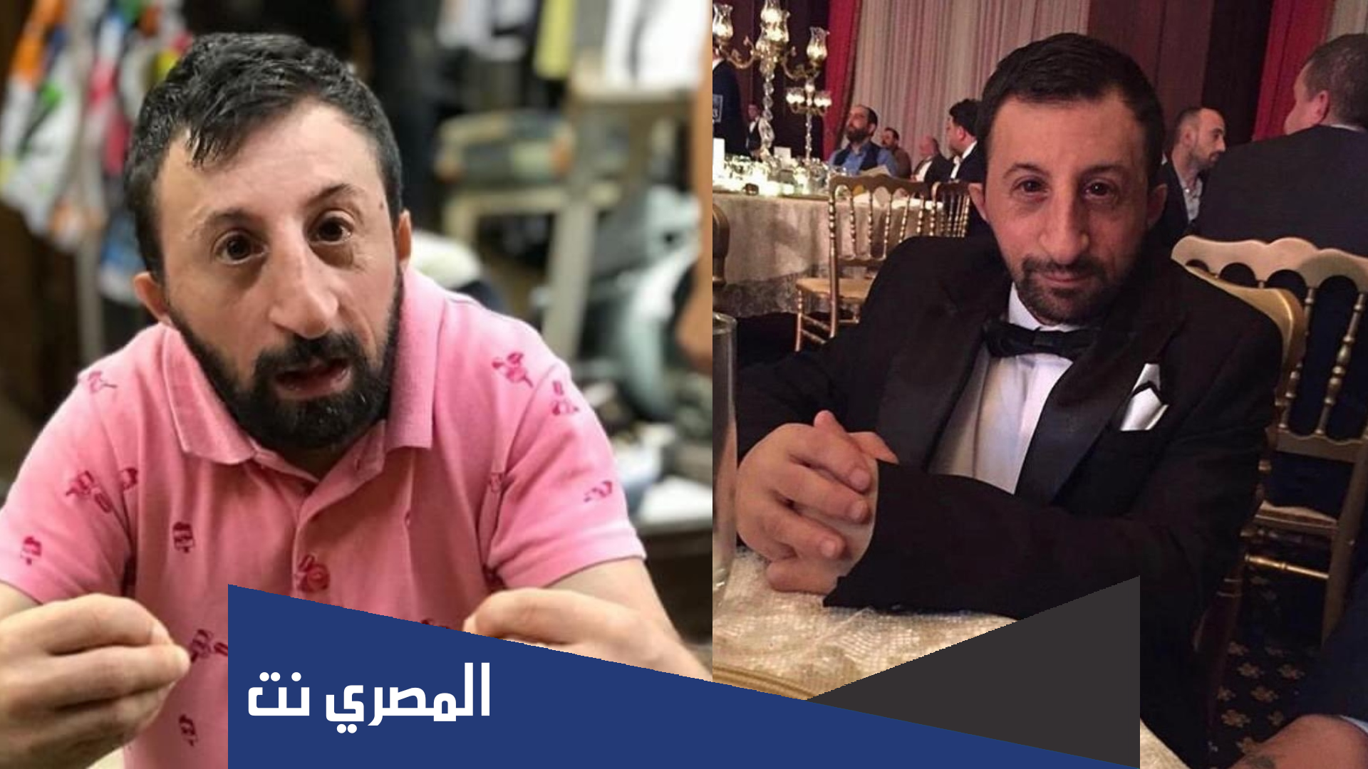 ماهو مرض كوسكال بابا