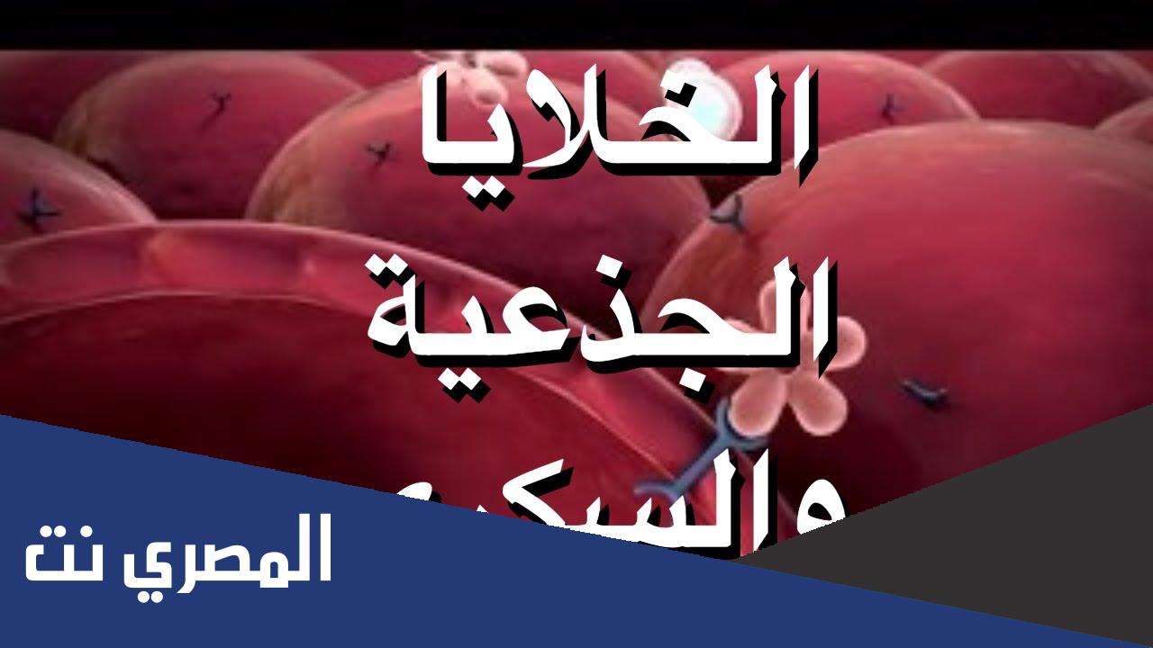 ما هي الخلايا الجذعية والسكري