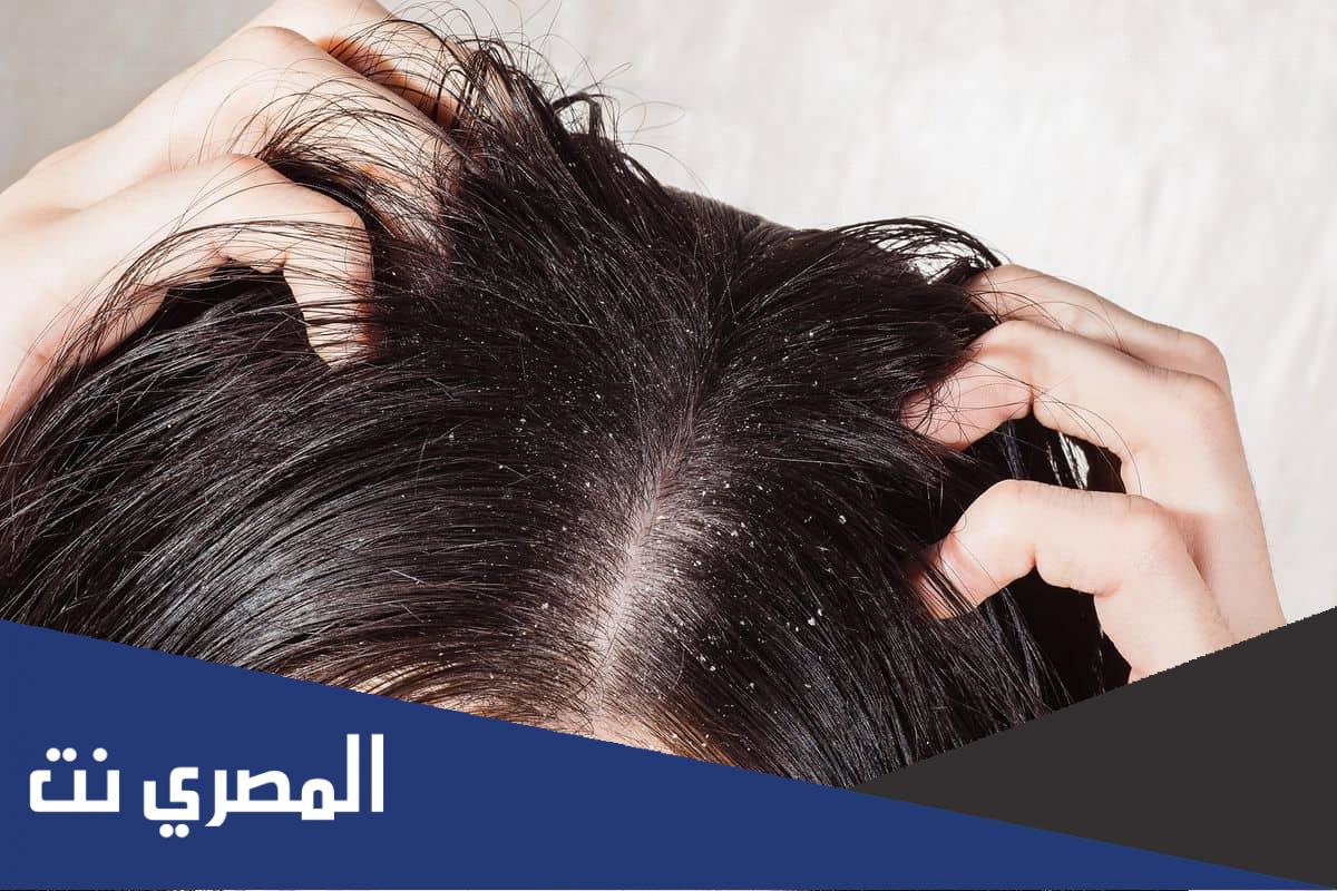 تفسير حلم القمل في الشعر وقتله لابن سيرين للحامل