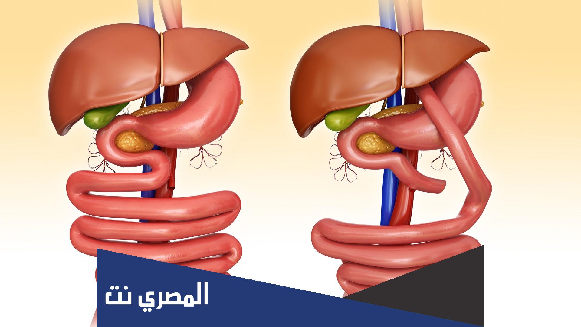 ما هي عملية تحويل المسار ؟