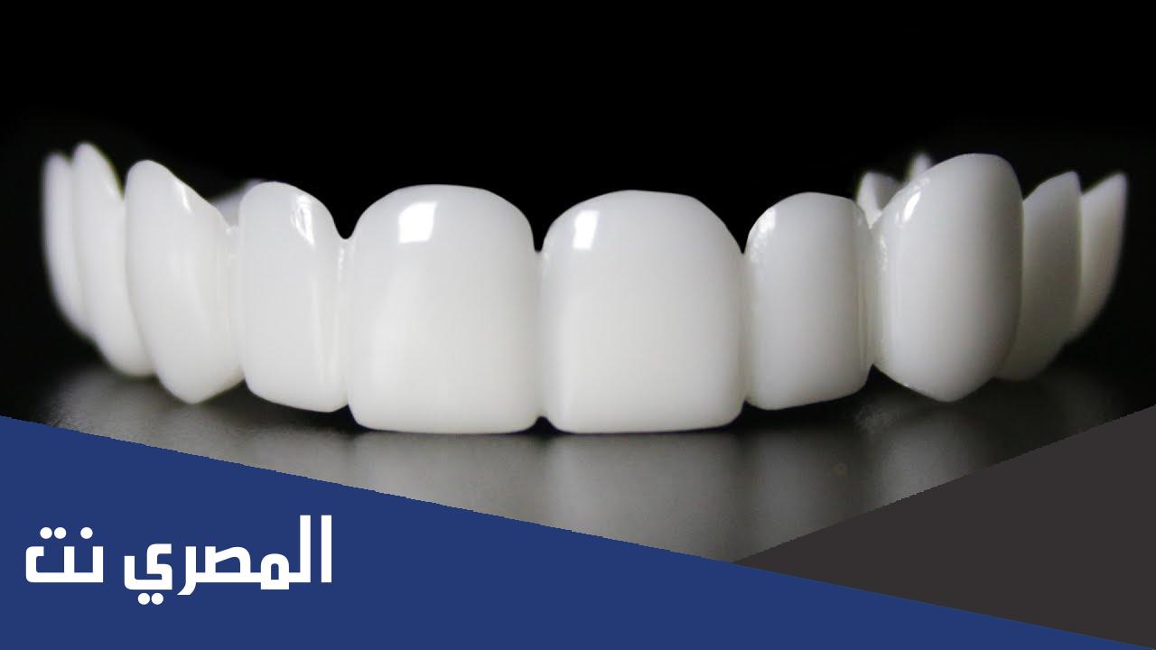 ابتسامة هوليود المتحركة | النصائح والتكلفة وأكثر