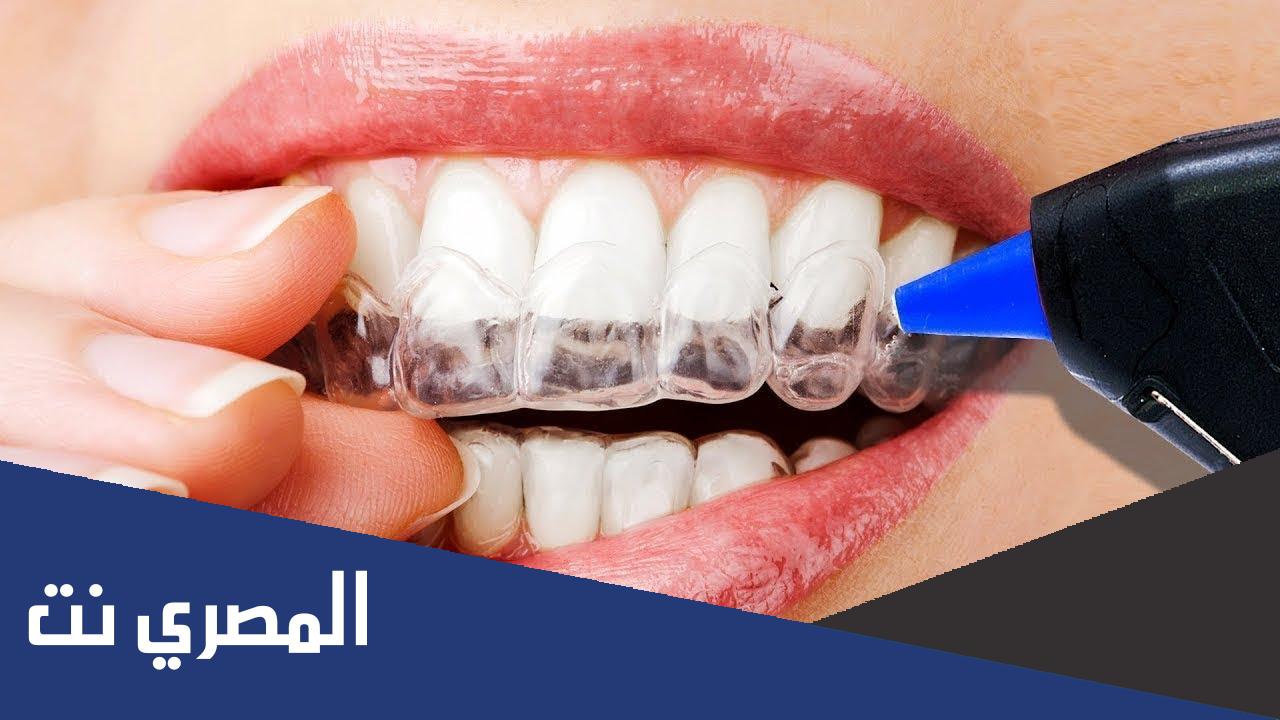 اسعار تلبيس الاسنان في السعودية زيركون وبورسلين