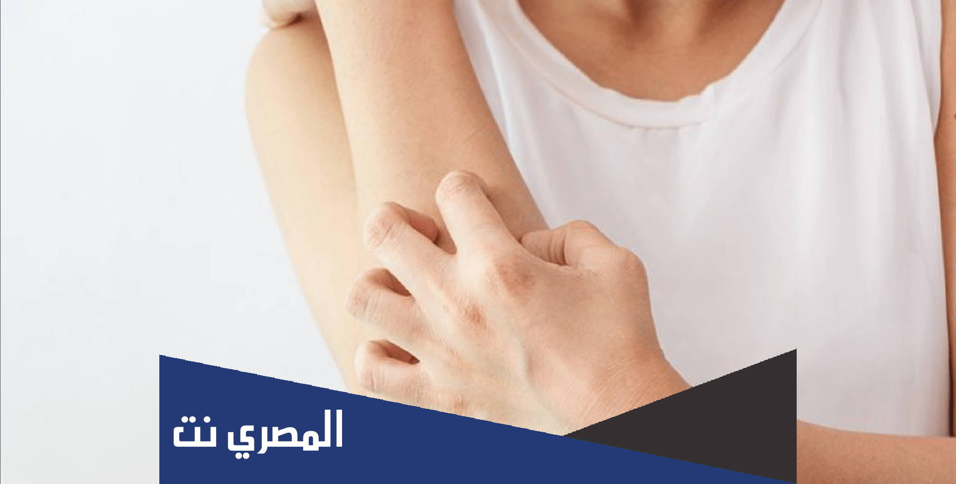 العلاج النهائي للارتكاريا علاج الارتكاريا الحكة الشديدة مجرب