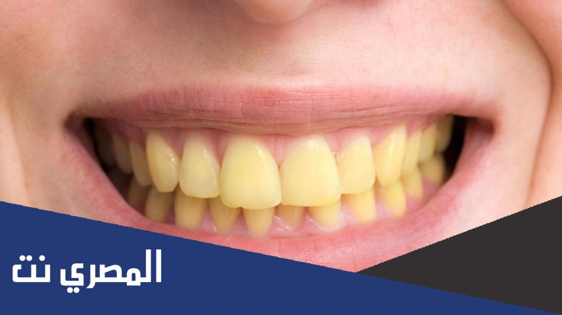 تفسير حلم الأسنان السوداء