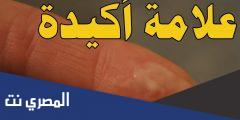شكل إفرازات الحمل قبل الدورة بالصور