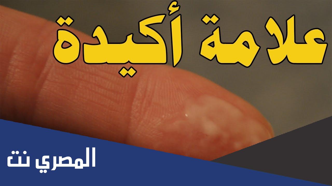 شكل إفرازات الحمل قبل الدورة بالصور