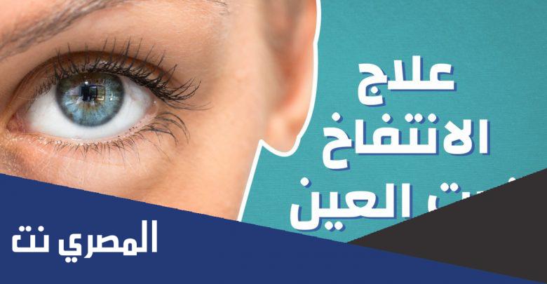 علاج الانتفاخ تحت العين طبيعيًا وطبيًا