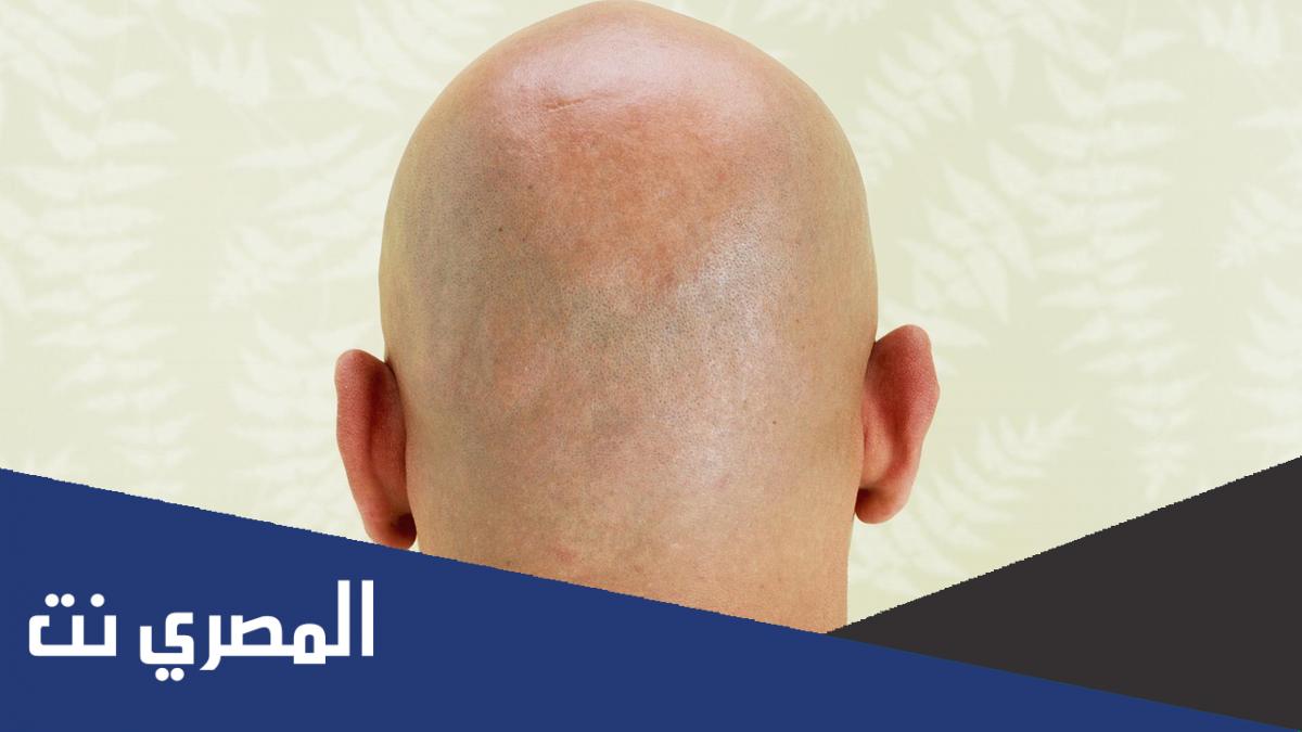 قصة مثل جبنا الاقرع يونسنا