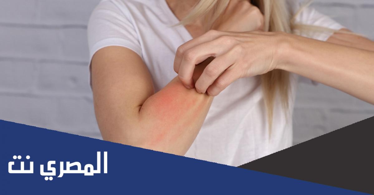 ما هو أفضل كريم حساسية للحامل شرح طريقة استخدامه