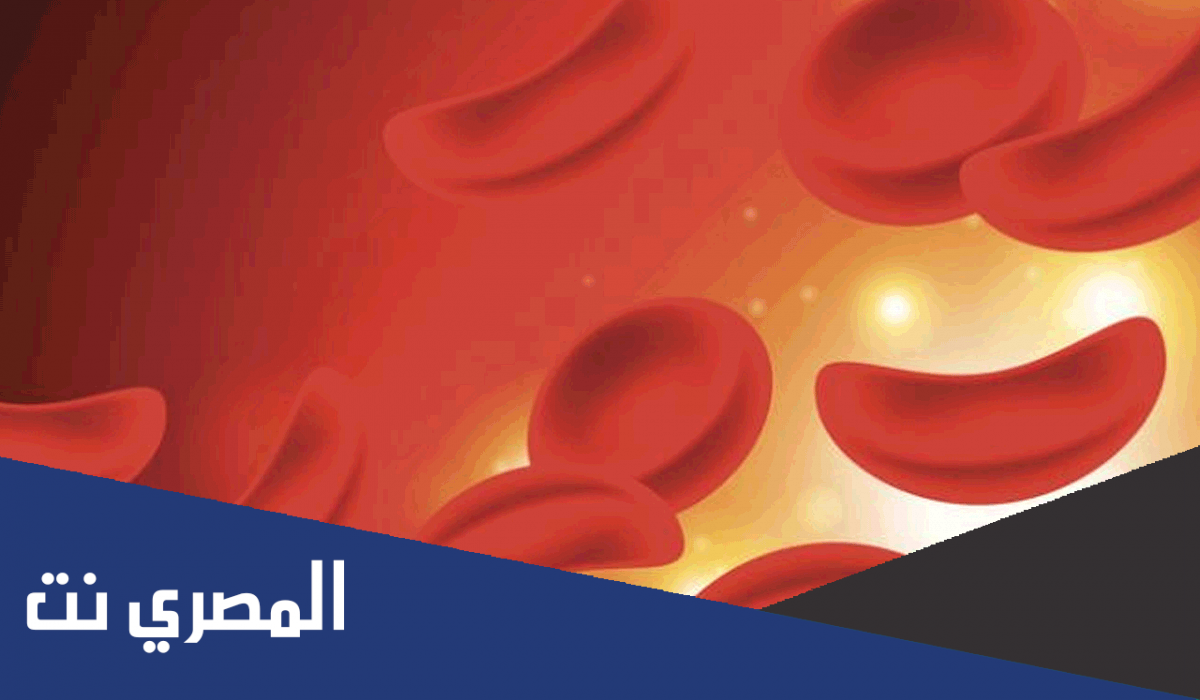 ما هو فقر الدم المنجلي واعراضه