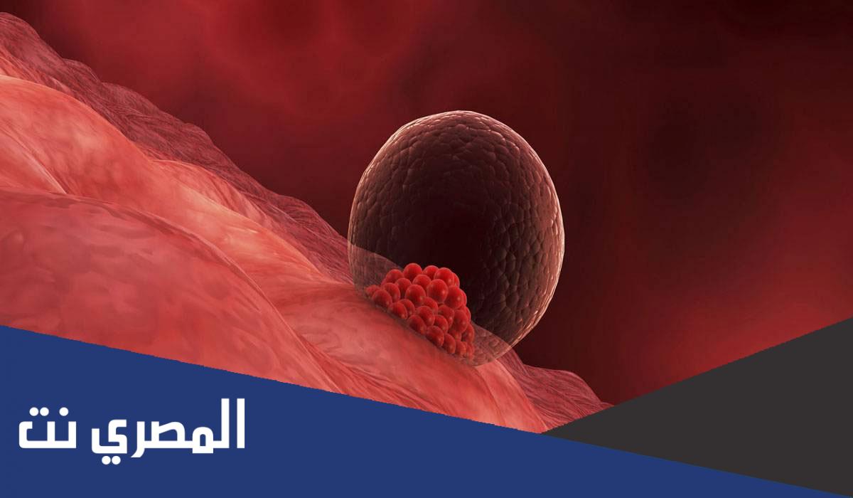 نزول قطع دم مع الدورة هل هو حمل