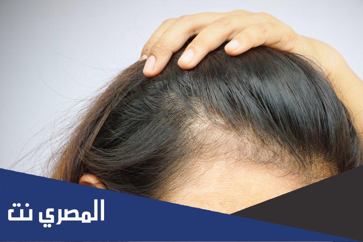 اسعار زراعة الشعر في السعودية واهم العيادات والأطباء