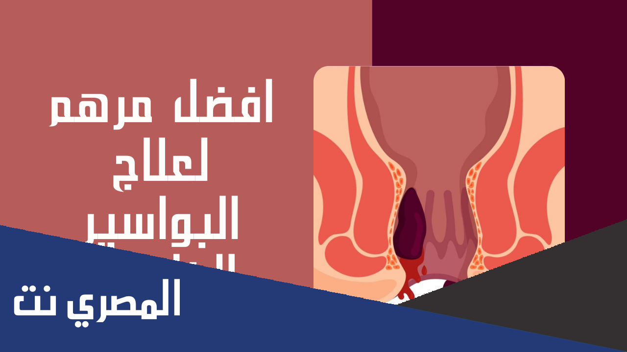 اسم افضل مرهم للبواسير