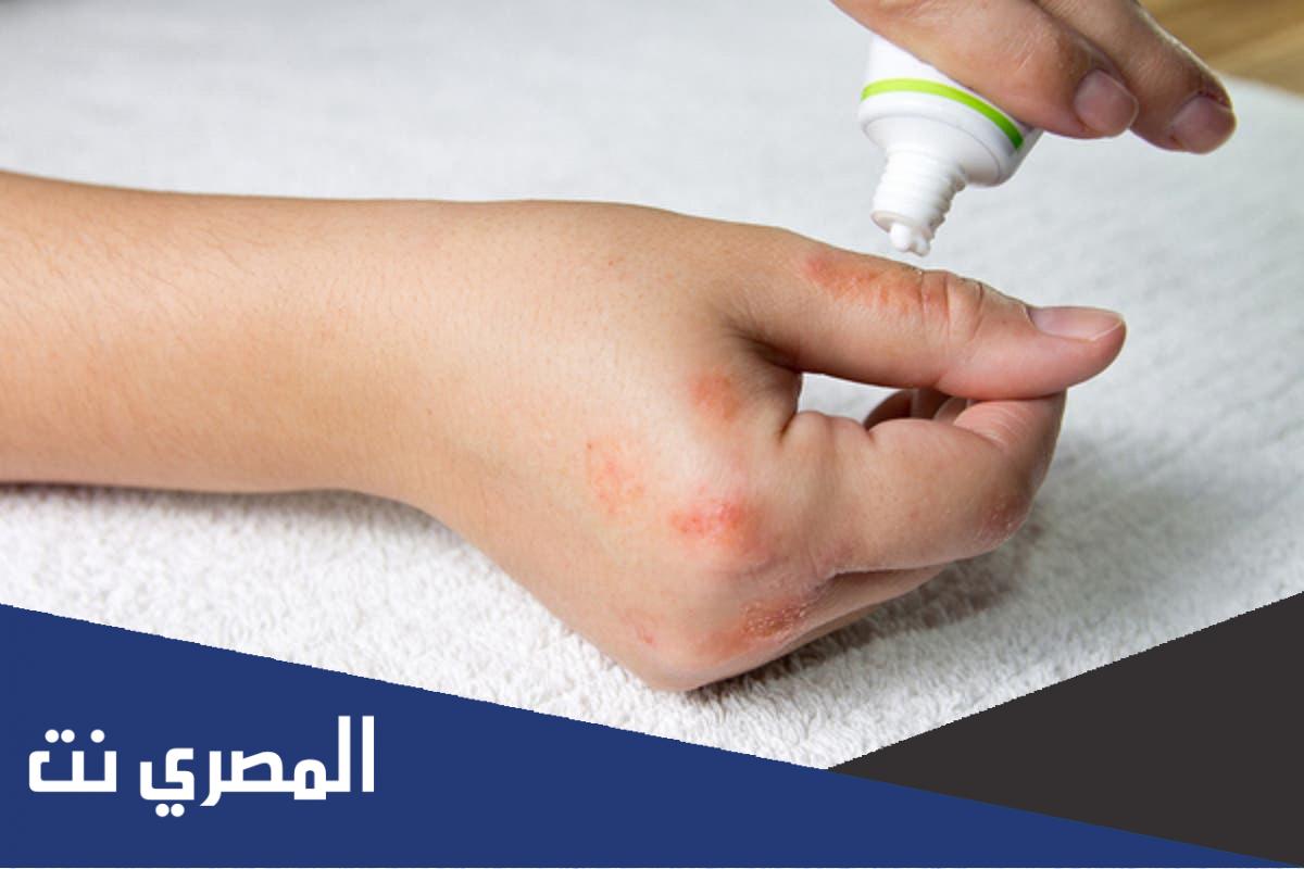 افضل أنواع كريم ديرموفيت واستخداماته