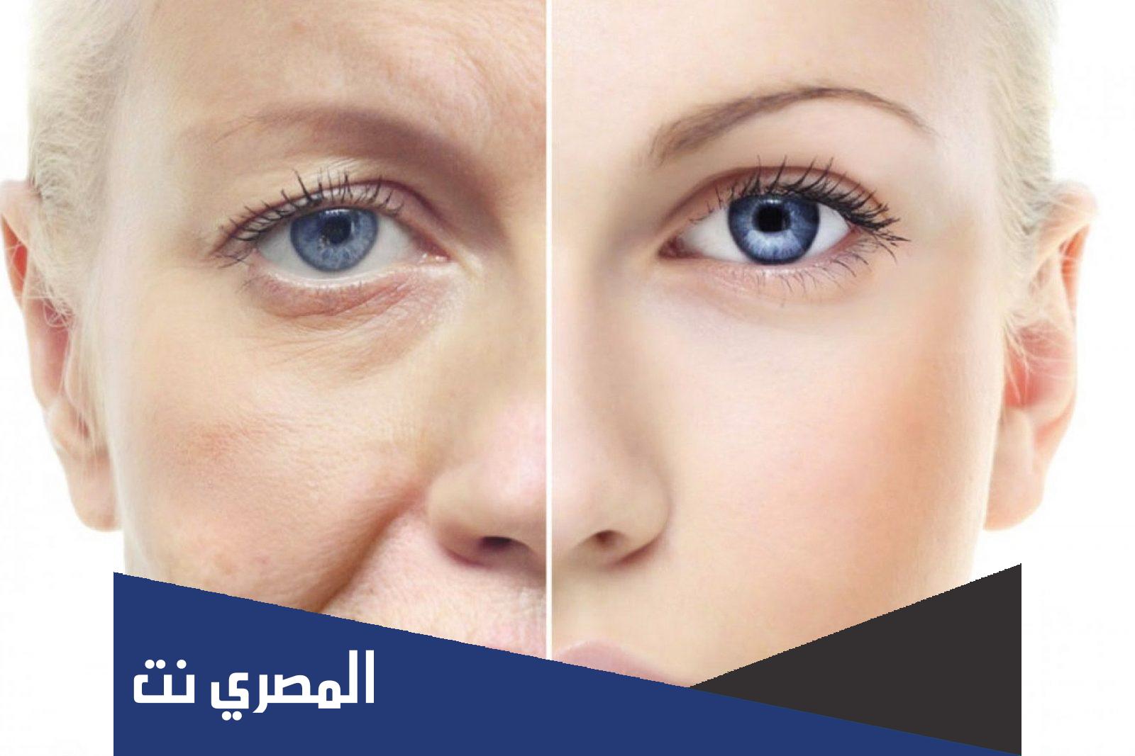 تجربتي مع الخلايا الجذعية للبشرة