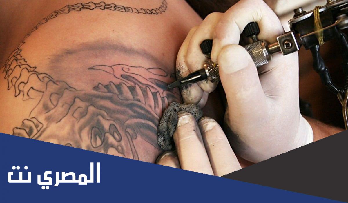 حكم التاتو المؤقت بالليزر