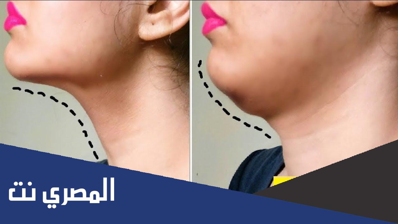 طريقة إزالة الذقن المزدوج | الأسباب والتكلفة والنتائج