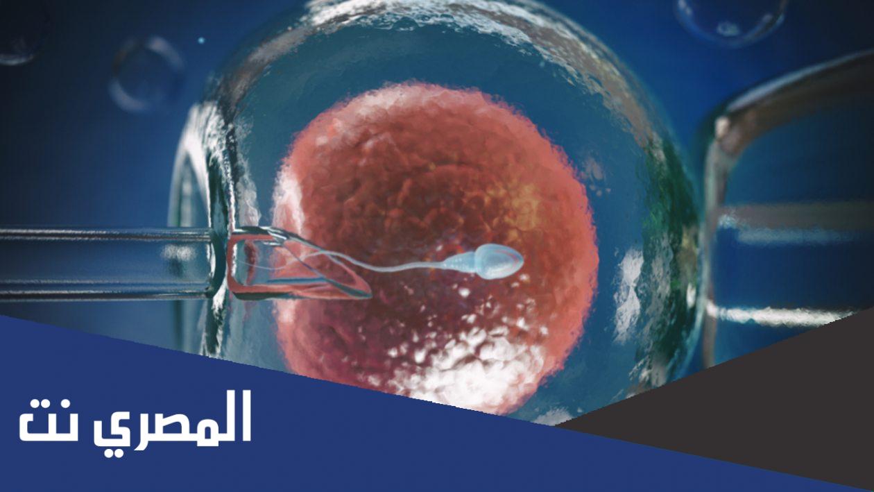 كم تكلفة الحقن المجهري في مستشفى الأمم 2022