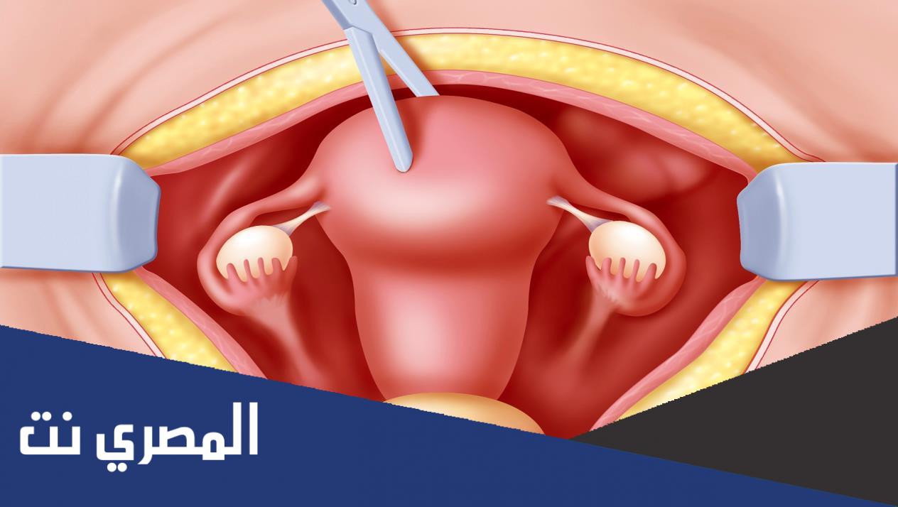 ما هو قص العجان