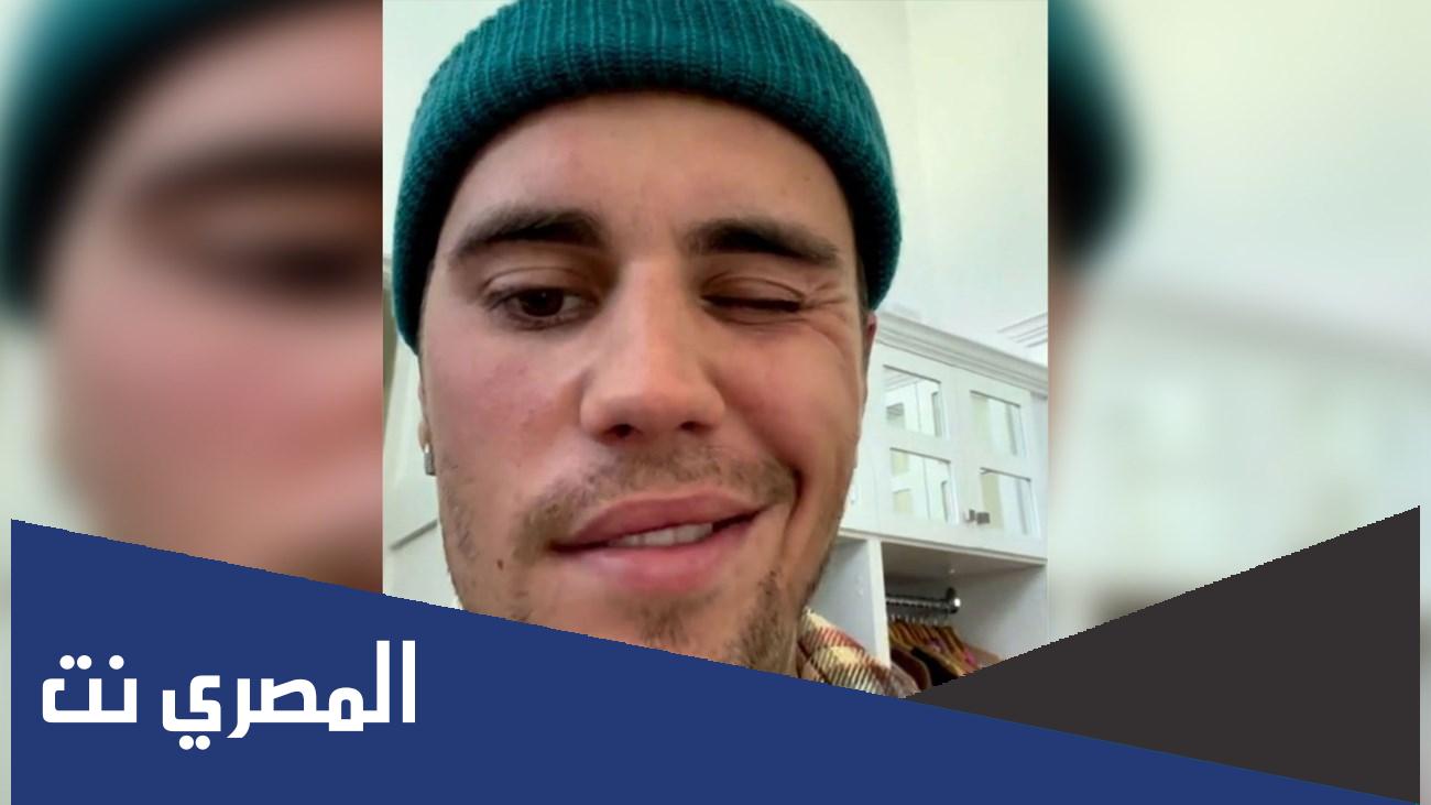 ما هي متلازمة رامزي هانت
