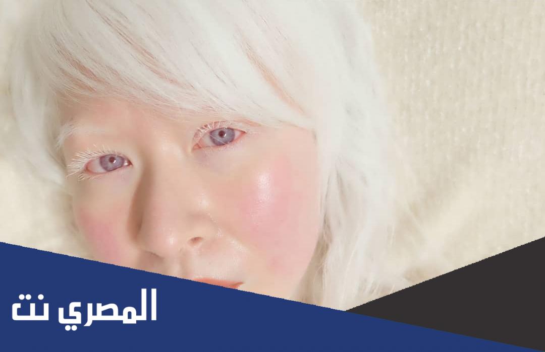 افتح بشره بنت في العالم العربي