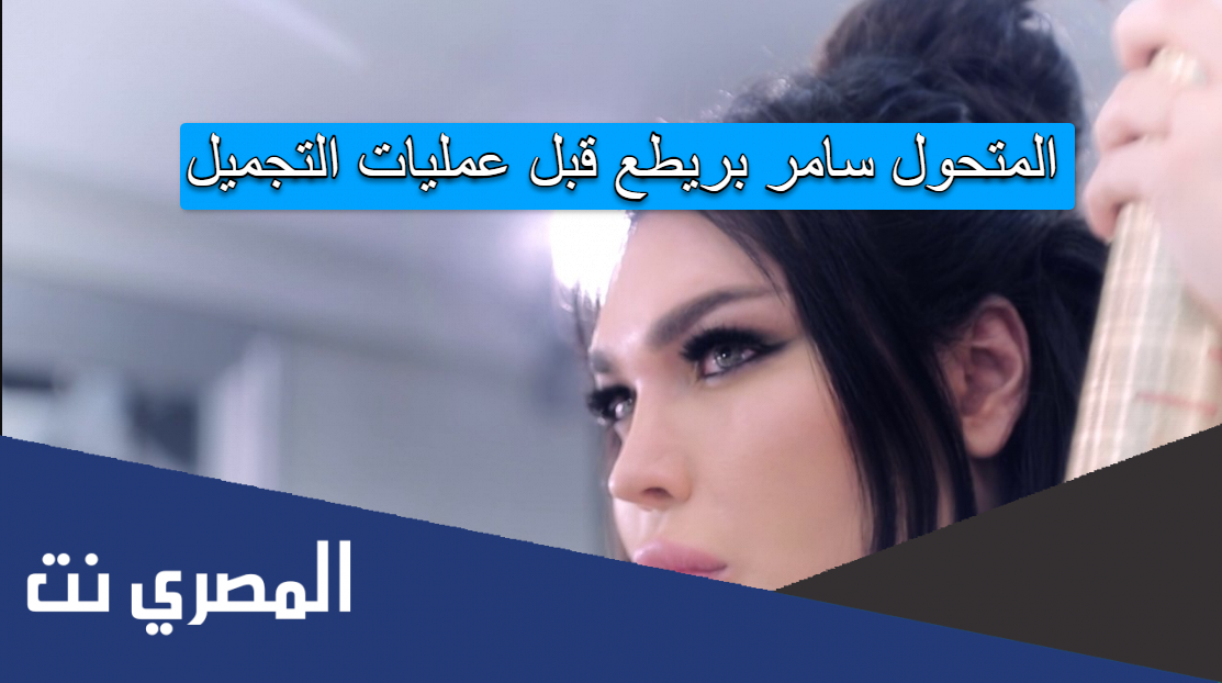المتحول سامر بريطع قبل عمليات التجميل