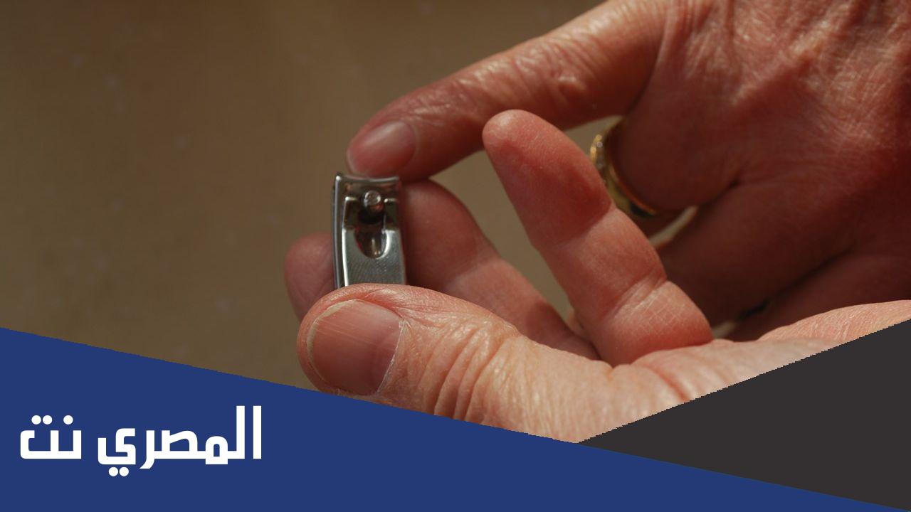 لماذا لا يجوز قص الشعر والأظافر للمضحي
