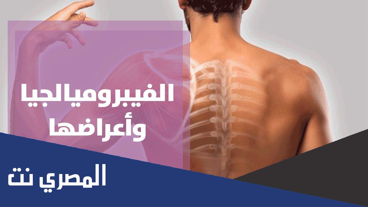مرض الفيبروميالجيا